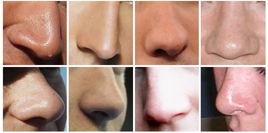 9067 - Relaciona cada nariz con el actor al que le pertenece [Parte 2]