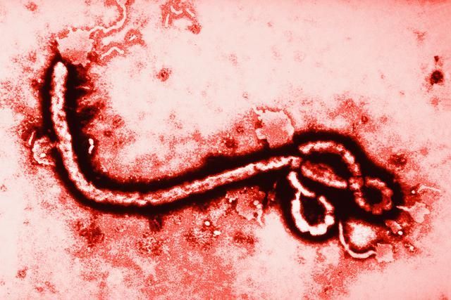 ¿Cuál de éstas es una forma de tratar el Ébola?