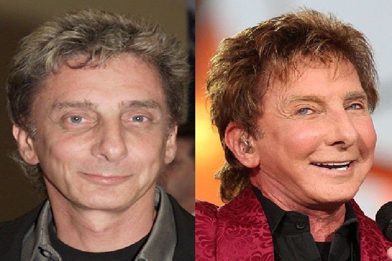Barry Manilow.