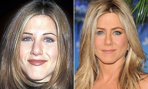 Jennifer Aniston (nariz)