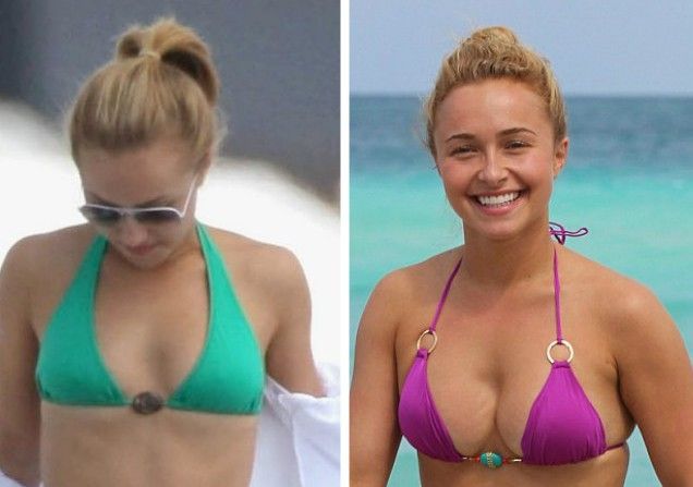 Hayden Panettiere (aumento de pecho)